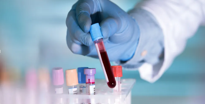 Blood Culture Test in Sepsis: How Early Detection Can Save Lives